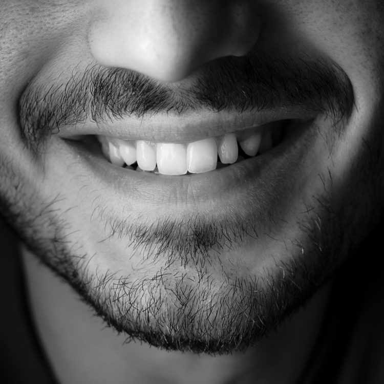worn teeth - closeup of mans mouth in black and white