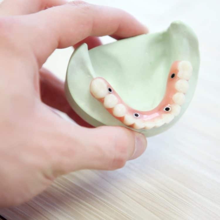 Dental implants - false teeth